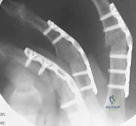 Clinical Image