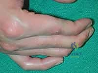 Clinical Image