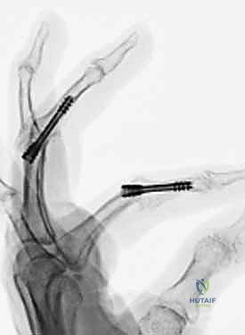 Clinical Image