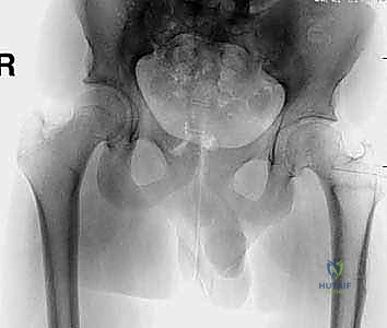 Clinical Image