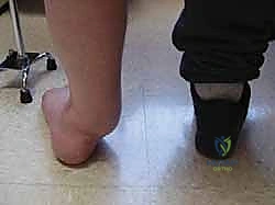 التشريح المعقد لمفصل الكاحل والقدم