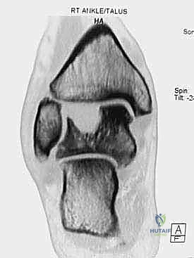 الدكتور محمد هطيف أثناء إجراء جراحة دقيقة