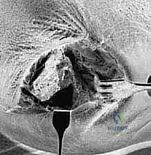 Clinical Image