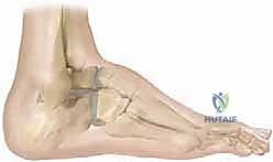 Clinical Image