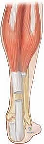 Clinical Image