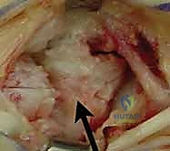 Clinical Image