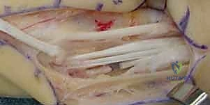 Clinical Image