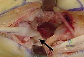 Clinical Image