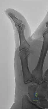 Clinical Image