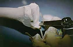 TECH FIG 4 Sawbones model demonstrating preparation of the arthrodesis site