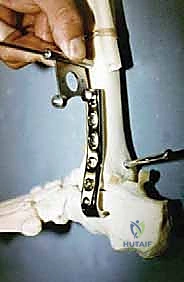 TECH FIG 5 continued D E