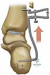 TECH FIG 5 continued D E