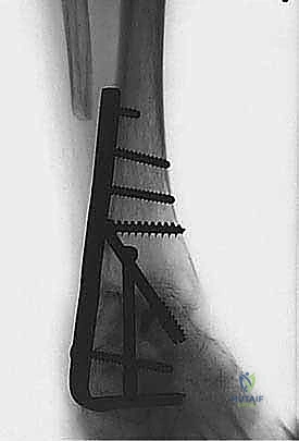 TECH FIG 6 continued BD