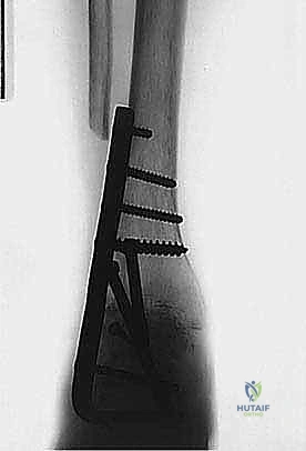 TECH FIG 6 continued BD