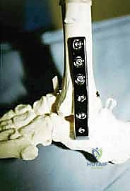 TECH FIG 6 continued BD