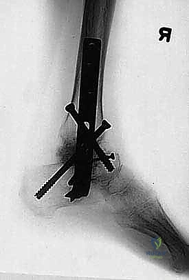 TECH FIG 6 continued BD