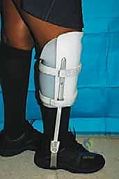 TECH FIG 8 Lateral approach to ankle and subtalar joint after distal fibular resection