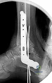 TECH FIG 11 continued F