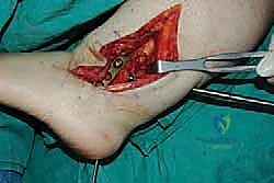 TECH FIG 11 continued F