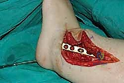 TECH FIG 11 continued F