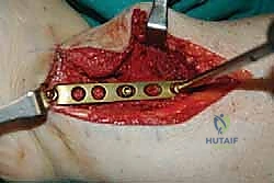 TECH FIG 11 continued F