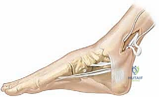التدخل الجراحي الدقيق باستخدام أحدث التقنيات