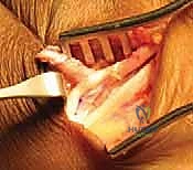 البروفيسور محمد هطيف أثناء التقييم السريري