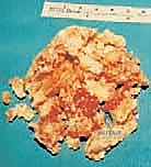 التشريح المعقد للقدم والكاحل وعظم الكاحل