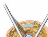 الأربطة والأوتار المحيطة بمفصل الكاحل وأهميتها