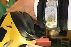 صورة توضيحية لـ منظار الكاحل: دليل شامل للعلاج الدقيق لمفصل القدم مع الأستاذ الدكتور محمد هطيف في صنعاء