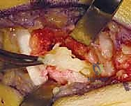 التشريح المعقد للقدم والمفصل تحت الكاحل