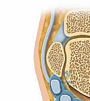 متلازمة انحشار الكاحل الخلفي: دليلك الشامل للتشخيص والعلاج مع الأستاذ الدكتور محمد هطيف