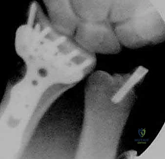 Clinical Image