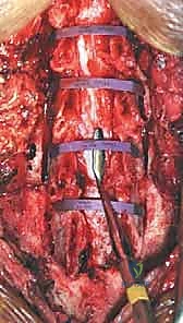 التشريح الدقيق للعمود الفقري العنقي