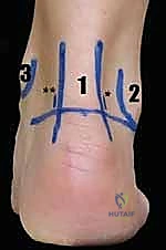 غرفة العمليات المجهزة