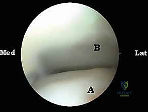 العلاج الطبيعي والتأهيل