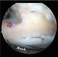وضعية المريض أثناء الجراحة