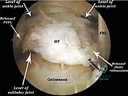 التحضير للعملية الجراحية