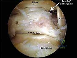 التصوير بالرنين المغناطيسي