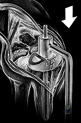 التشخيص الدقيق بالأشعة في عيادة الدكتور هطيف