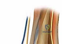 المعالجة الجراحية الدقيقة داخل المفصل