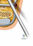التخدير ووضعية المريض في غرفة العمليات