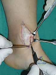 التركيب الهندسي لمفصل الكاحل