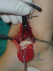 تجهيزات الجراحة الميكروسكوبية