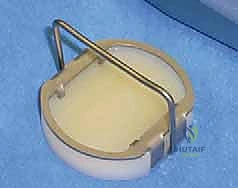 الأستاذ الدكتور محمد هطيف رائد جراحة العظام في اليمن