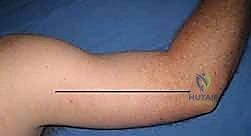 طرق تشخيص متلازمة الحيز