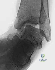 تجهيزات غرفة العمليات الحديثة