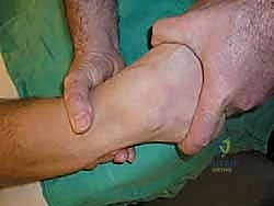 صورة توضيحية للفحص السريري للكاحل