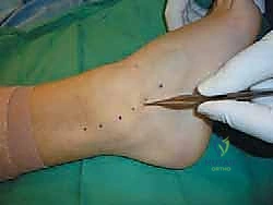 تجهيز موقع الخطاطيف