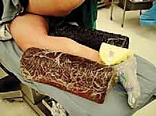 صورة تفصيلية للتشريح الجراحي